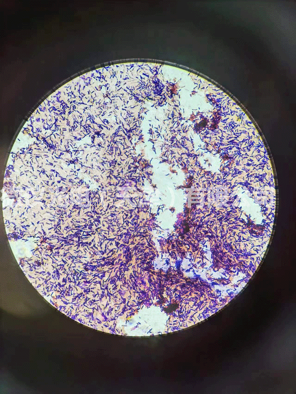 用免费看片18禁光电免费看片软件下载进行芽孢及革兰氏染色杆菌的观察